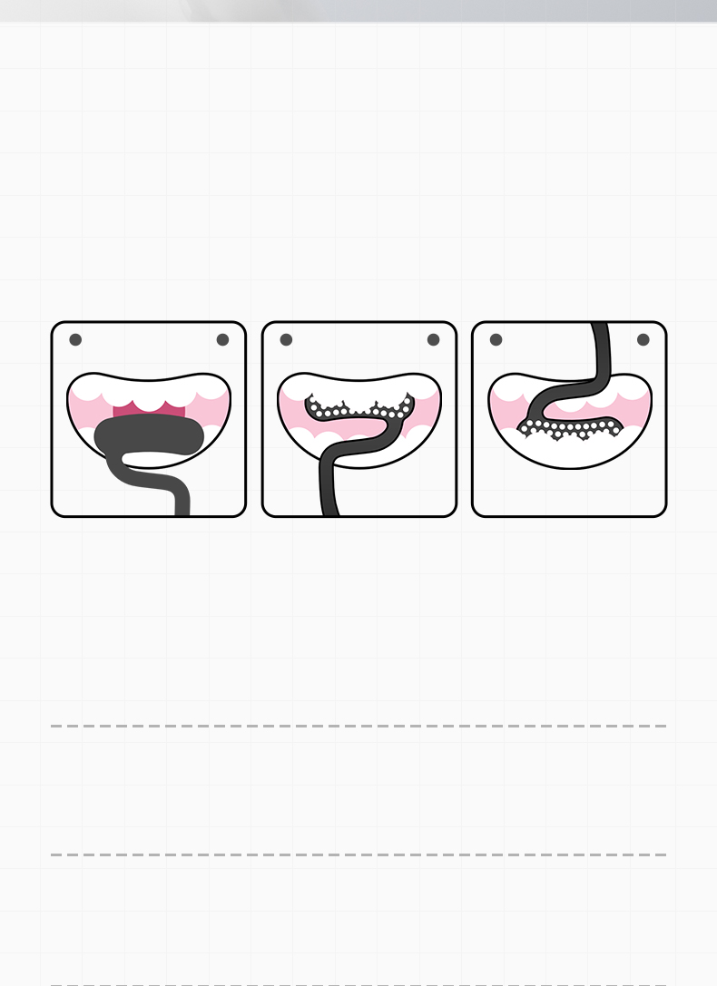 Sweetrip T-Shaped Ultra-Soft Bristle Toothbrush (0.1mm) 