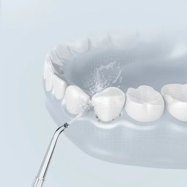 OralGos FC-180 Professional Jet Water Flosser