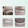 Interdental Brushes Toothbrush (2) Push-Pull Interdental Brushes