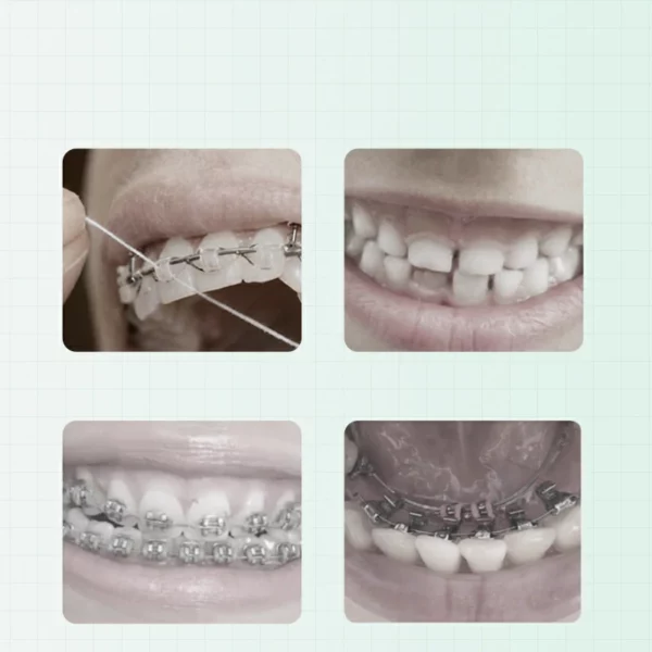 Interdental Brushes Toothbrush (2) Push-Pull Interdental Brushes