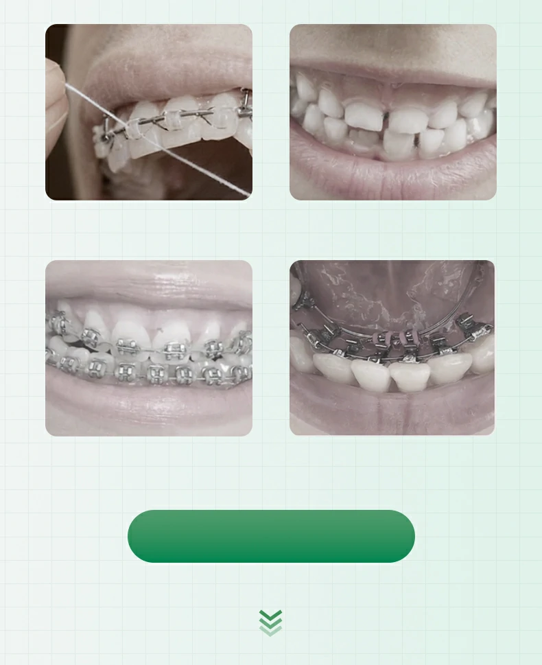 Interdental Brushes