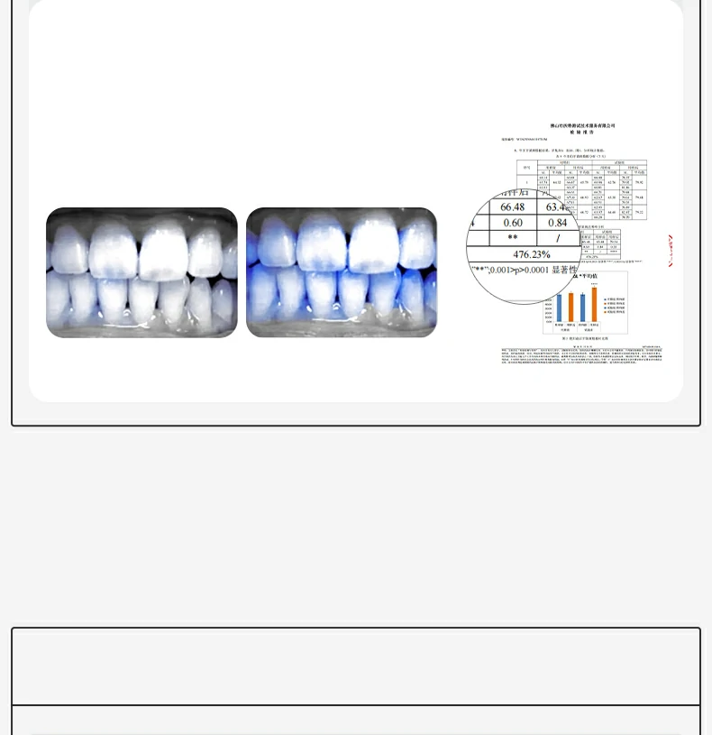 Custom Printed Toothbrush