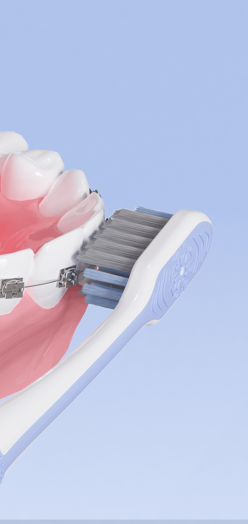 Orthodontic Toothbrush for Effective Braces Cleaning