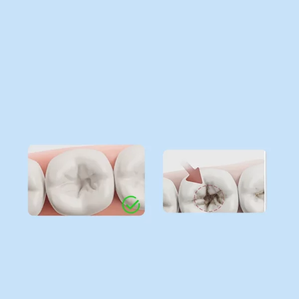 Convex Soft Bristle Adult Toothbrush