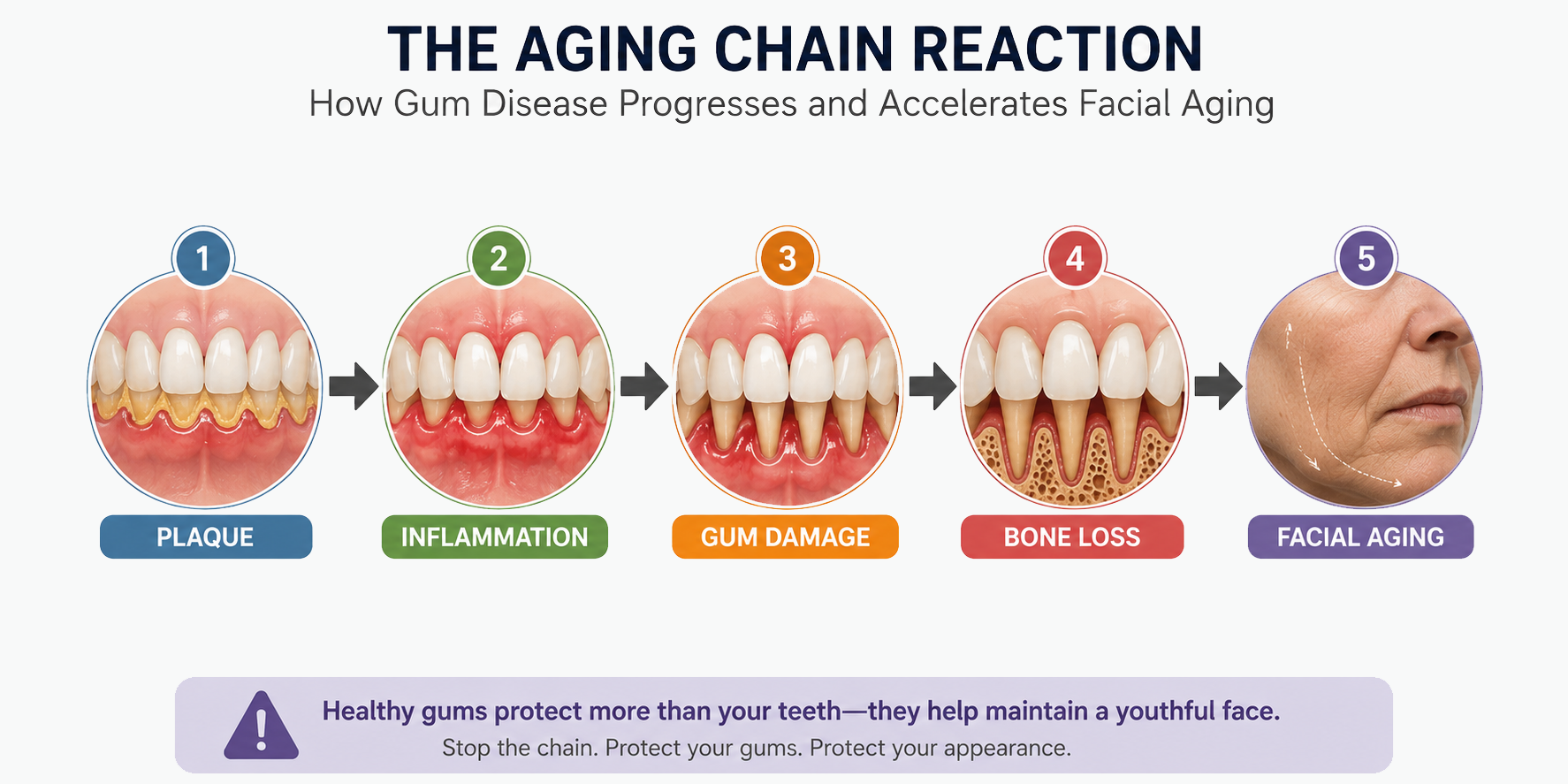 plaque inflammation gum damage bone loss facial aging progression diagram