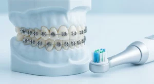 A high-definition close-up photo of modern fixed orthodontic braces on a dental model, positioned alongside a sleek electric toothbrush head with indicator bristles.