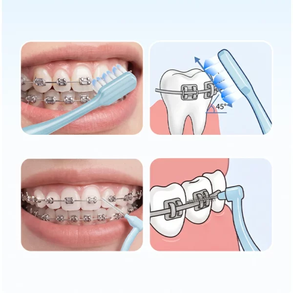 Orthodontic Toothbrush Set (11) Sweetrip Orthodontic Toothbrush Set with Interdental Brush