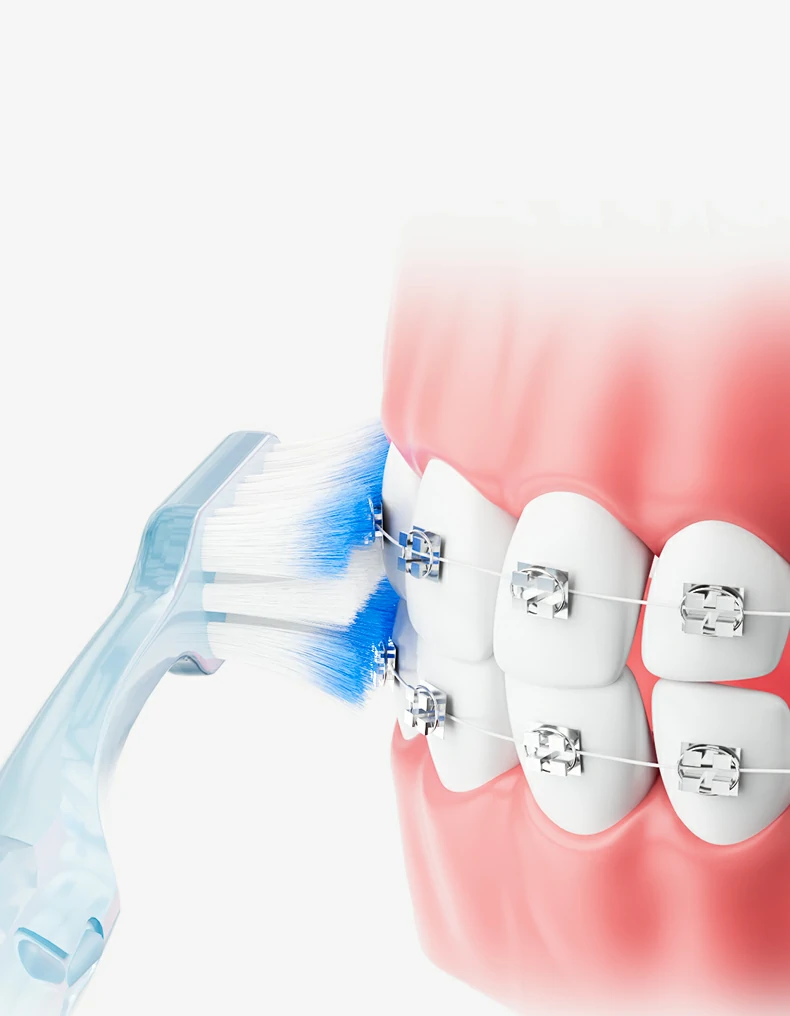 Sweetrip Orthodontic Toothbrush Set with Interdental Brush