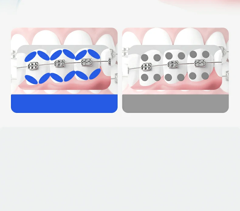 Sweetrip Orthodontic Toothbrush Set with Interdental Brush