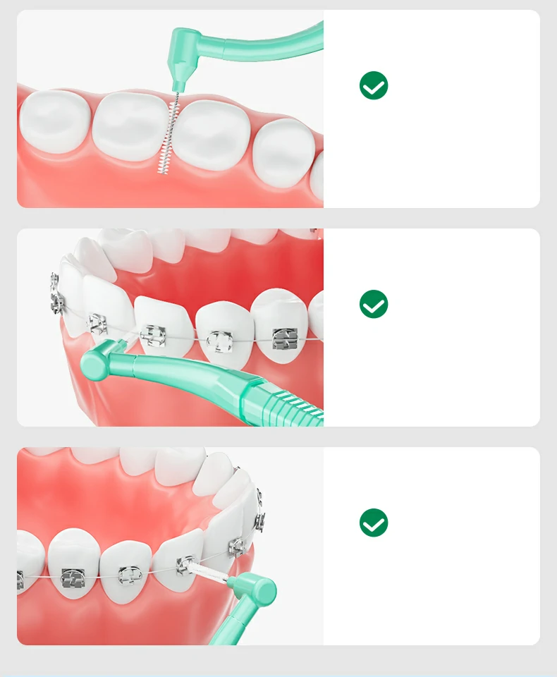 Sweetrip Orthodontic Toothbrush Set with Interdental Brush