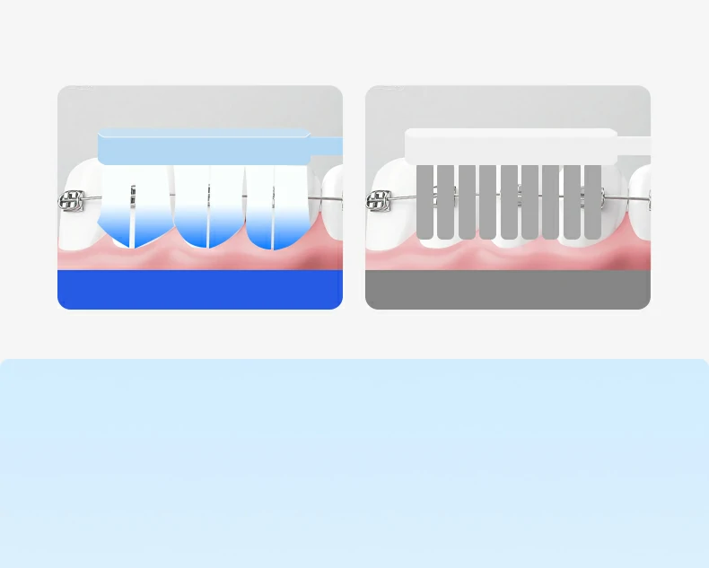 Sweetrip Orthodontic Toothbrush Set with Interdental Brush