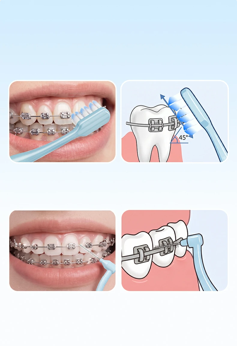 Sweetrip Orthodontic Toothbrush Set with Interdental Brush
