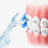 Orthodontic Toothbrush Set (5) Sweetrip Orthodontic Toothbrush Set with Interdental Brush