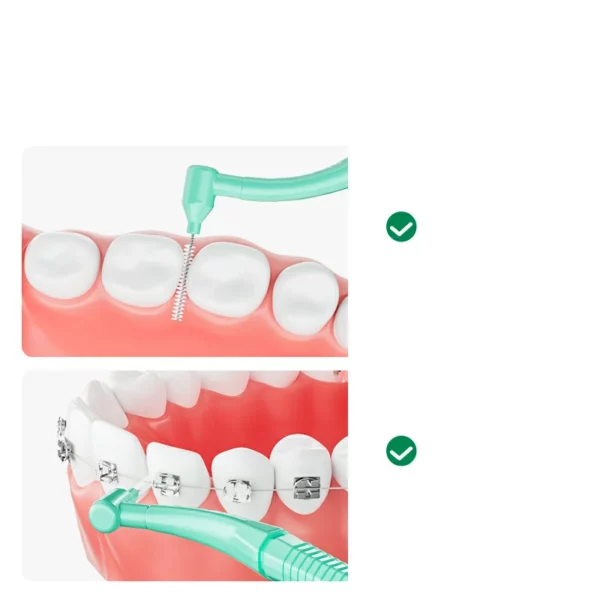 Orthodontic Toothbrush Set (8) Sweetrip S625 Orthodontic Toothbrush Set with Interdental Brush (2-Pack)